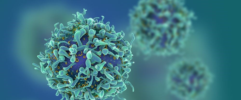 Prostat kanseri hücreleri yoğun ultrason dalgalarıyla öldürülüyor