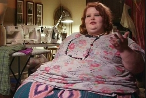 Morbid obez kadın bir yılda 90 kilo verdi